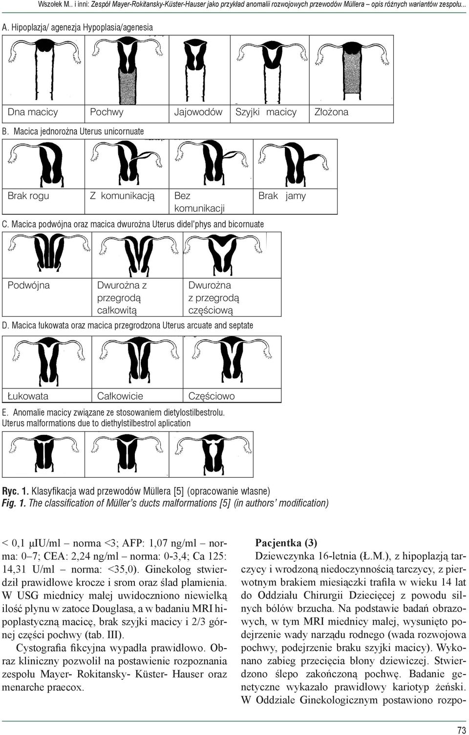 Anomalie macicy związane ze stosowaniem dietylostilbestrolu. Uterus malformations due to diethylstilbestrol aplication Ryc. 1.