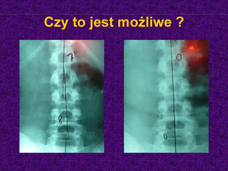 możliwe?