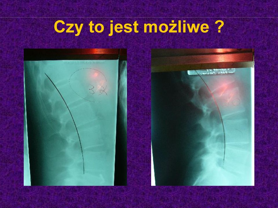 możliwe?