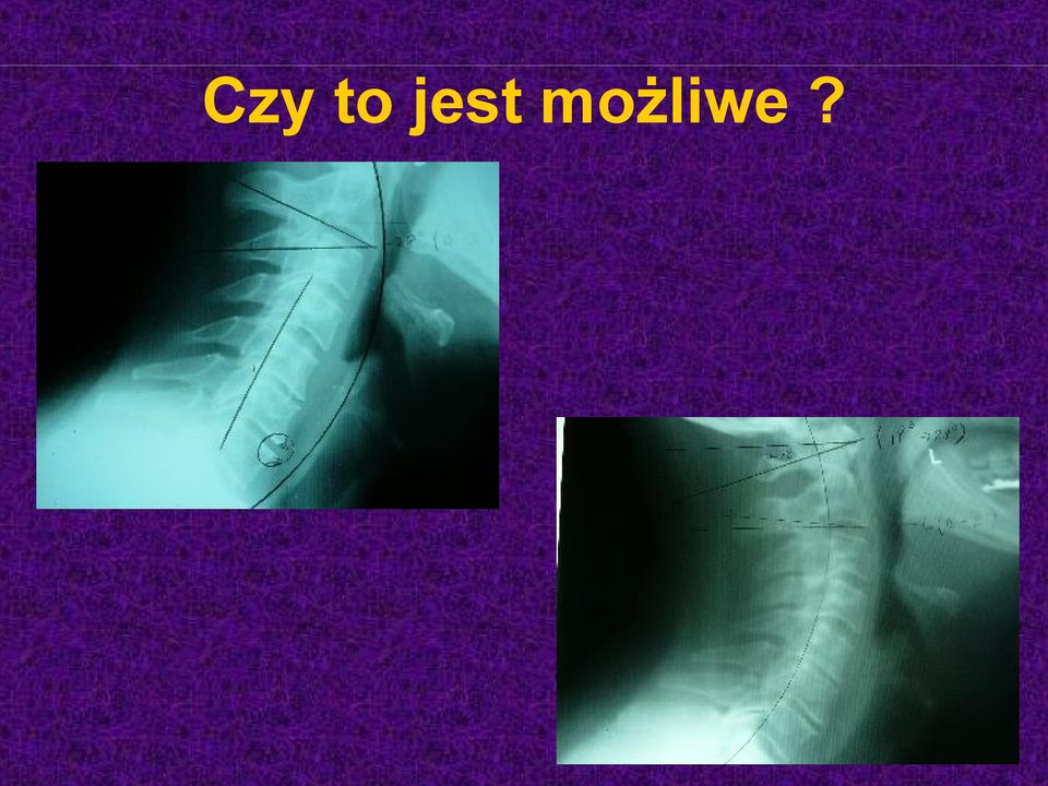 możliwe?