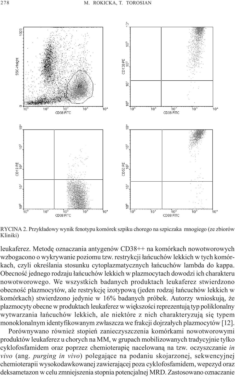 restrykcji ³añcuchów lekkich w tych komórkach, czyli okreœlania stosunku cytoplazmatycznych ³añcuchów lambda do kappa.