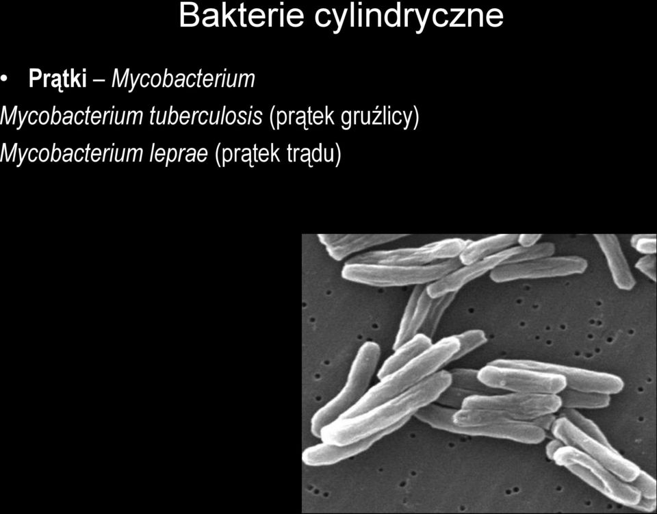 tuberculosis (prątek gruźlicy)