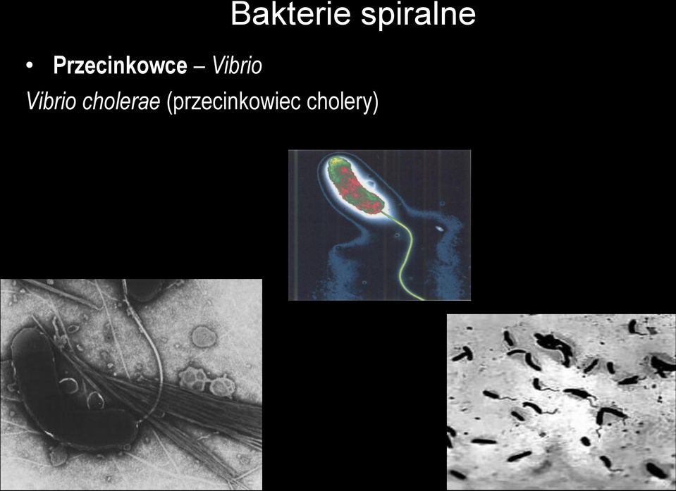 Vibrio cholerae