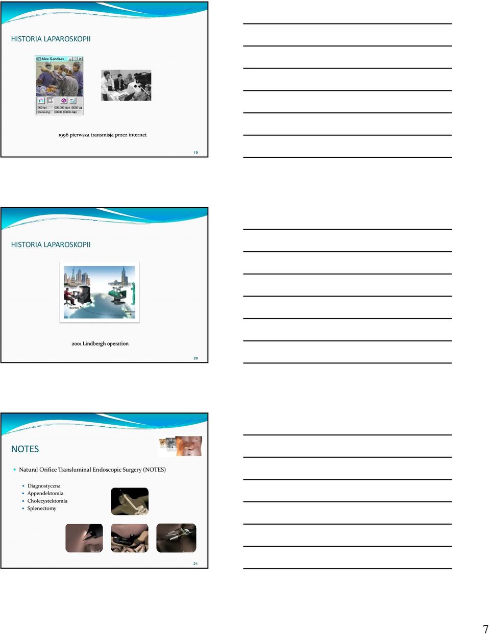 Transluminal Endoscopic Surgery (NOTES)