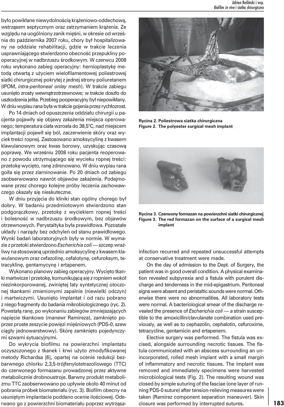 The red formazan on the surface of a surgical mesh implant było powikłane niewydolnością krążeniowo-oddechową, wstrząsem septycznym oraz zatrzymaniem krążenia.