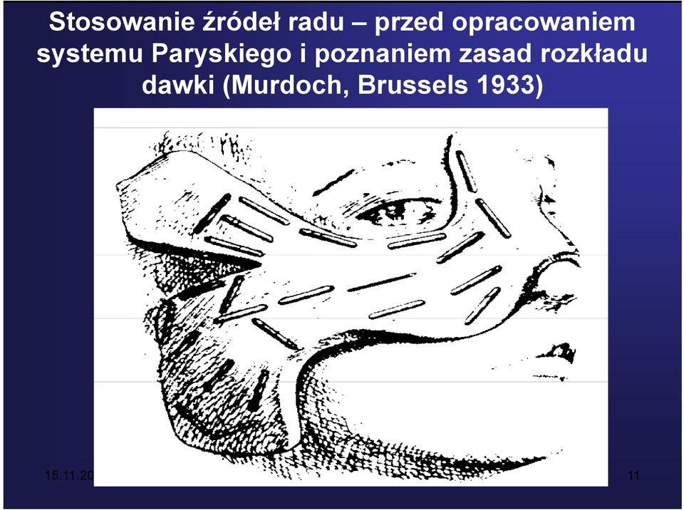 i poznaniem zasad rozkładu dawki