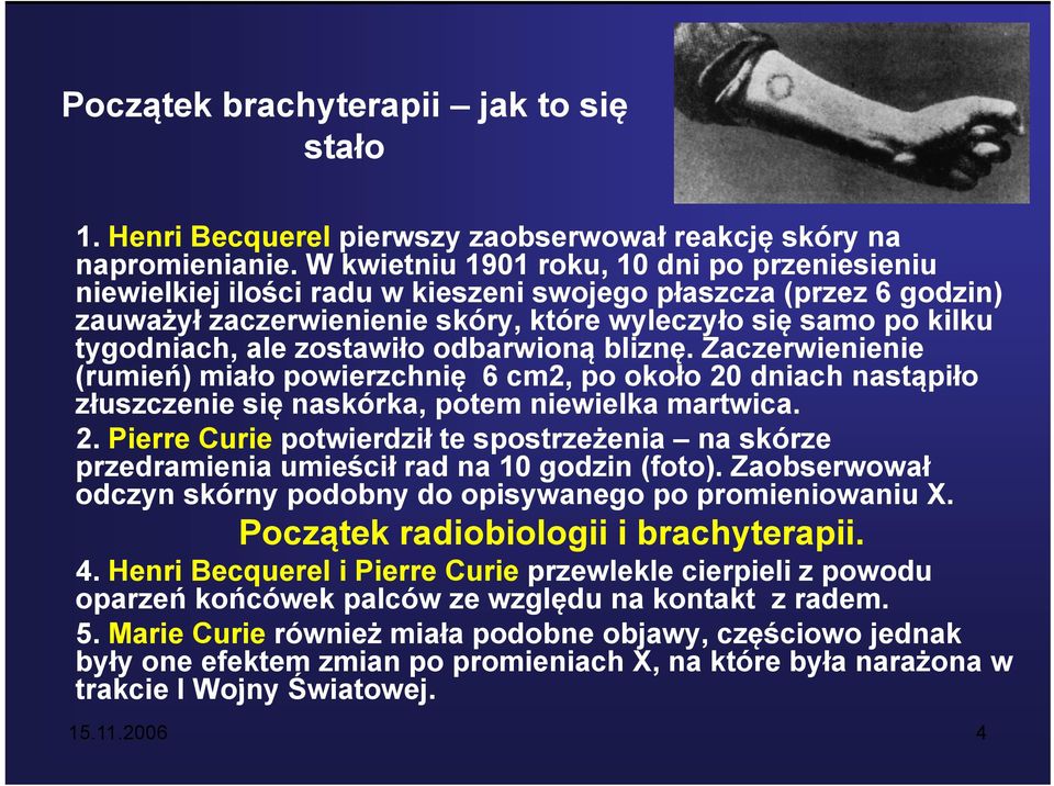 zostawiło odbarwioną bliznę. Zaczerwienienie (rumień) miało powierzchnię 6 cm2, po około 20 dniach nastąpiło złuszczenie się naskórka, potem niewielka martwica. 2. Pierre Curie potwierdził te spostrzeżenia na skórze przedramienia umieścił rad na 10 godzin (foto).