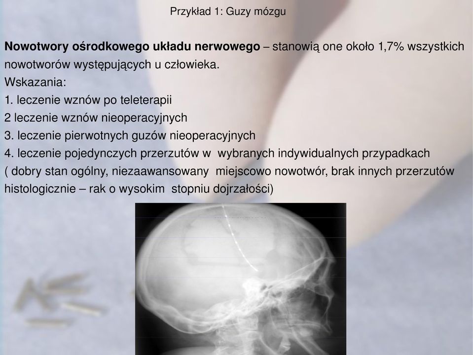 leczenie pierwotnych guzów nieoperacyjnych 4.