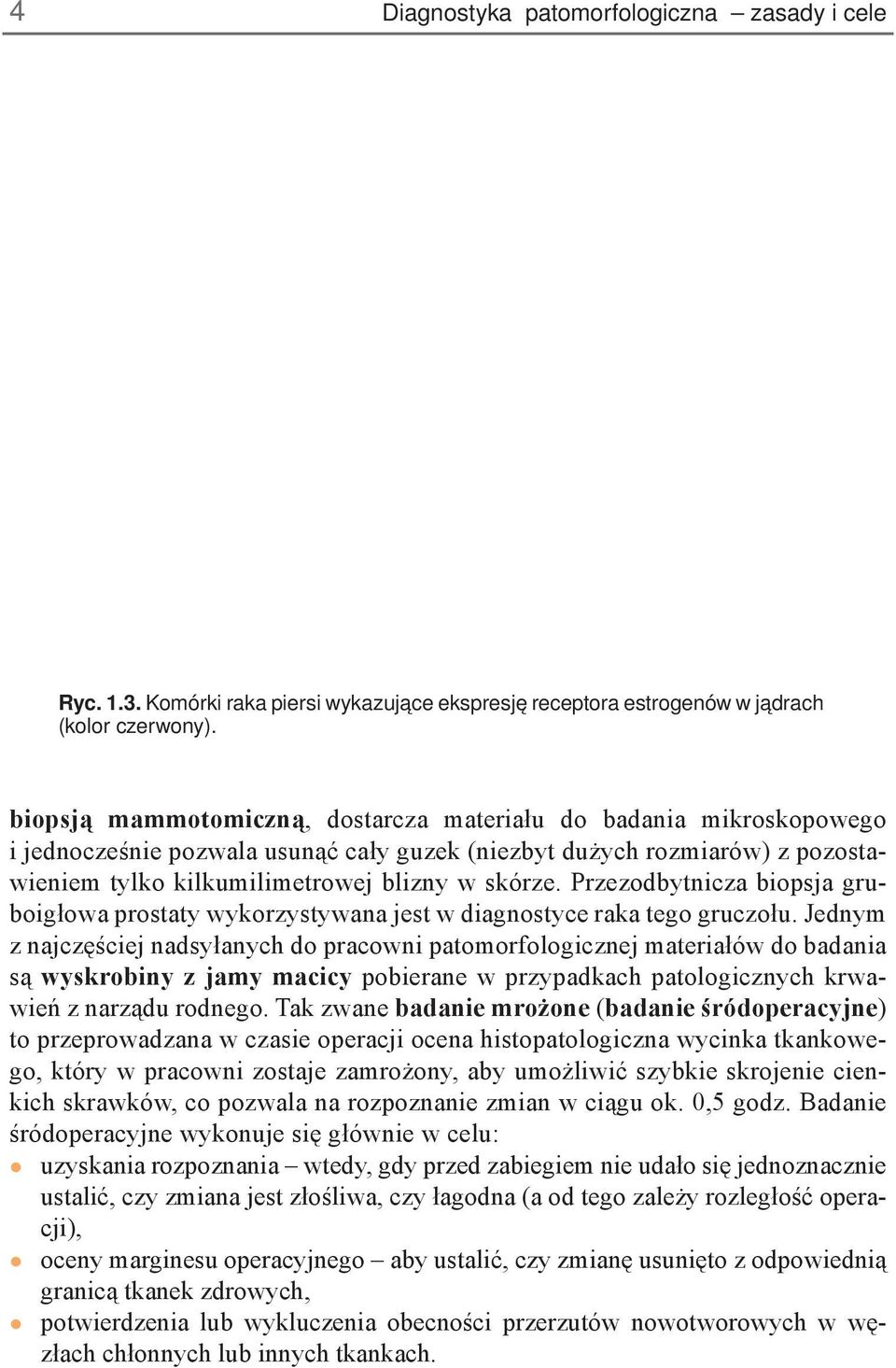 Przezodbytnicza biopsja gruboigłowa prostaty wykorzystywana jest w diagnostyce raka tego gruczołu.