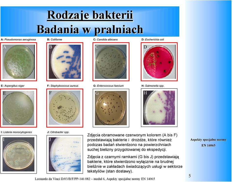 J Zdjęcia obramowane czerwonym kolorem (A bis F) przedstawiają bakterie i drożdże, które również podczas badań stwierdzono na powierzchniach suchej bielizny przygotowanej do