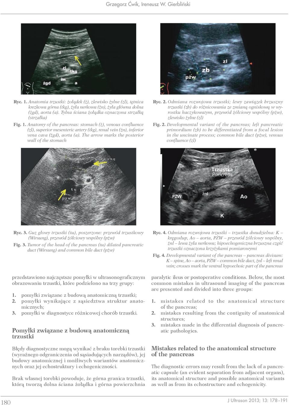 Anatomy of the pancreas: stomach (ż), venous confluence (zl), superior mesenteric artery (tkg), renal vein (żn), inferior vena cava (żgd), aorta (a).