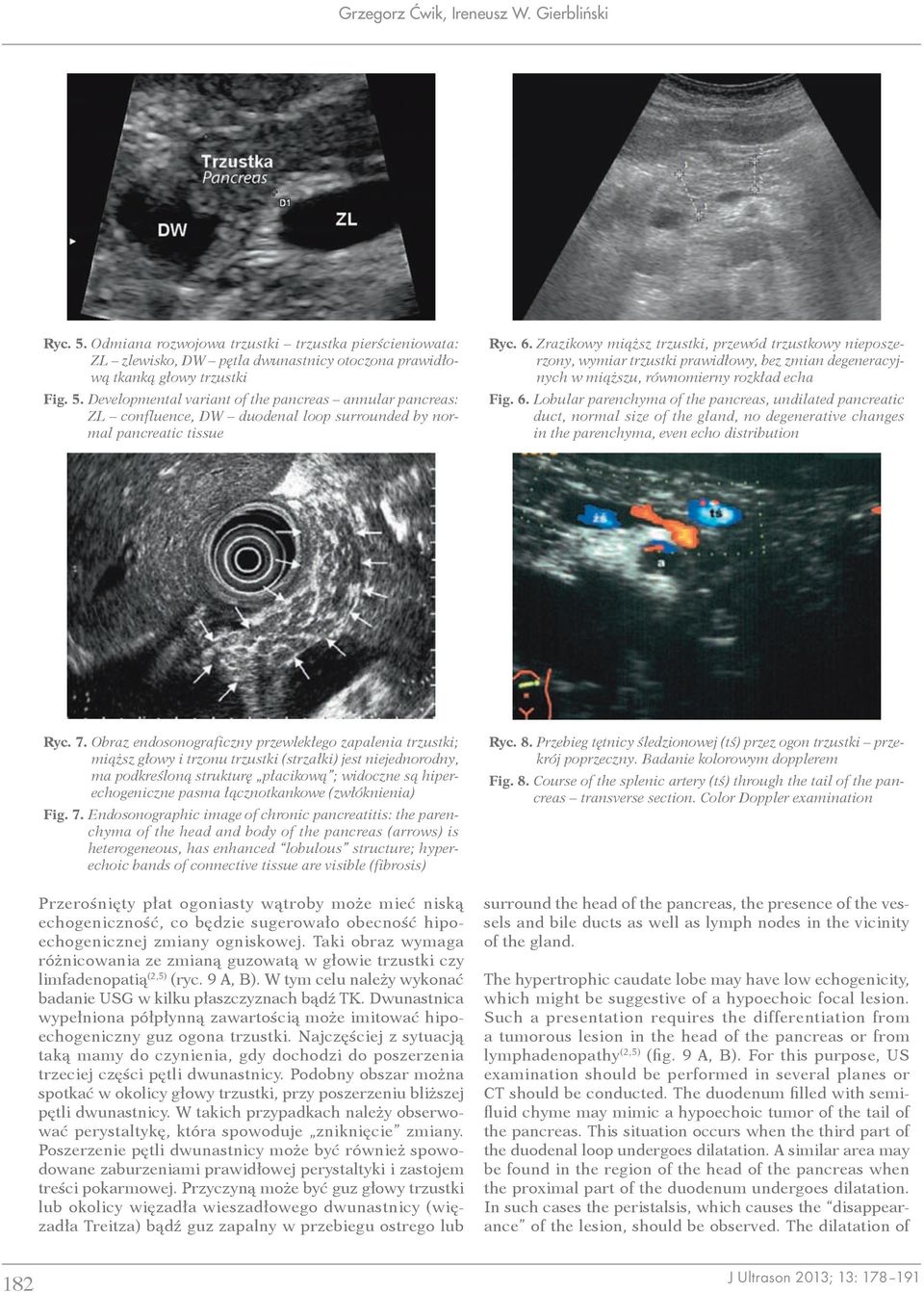 Lobular parenchyma of the pancreas, undilated pancreatic duct, normal size of the gland, no degenerative changes in the parenchyma, even echo distribution Ryc. 7.