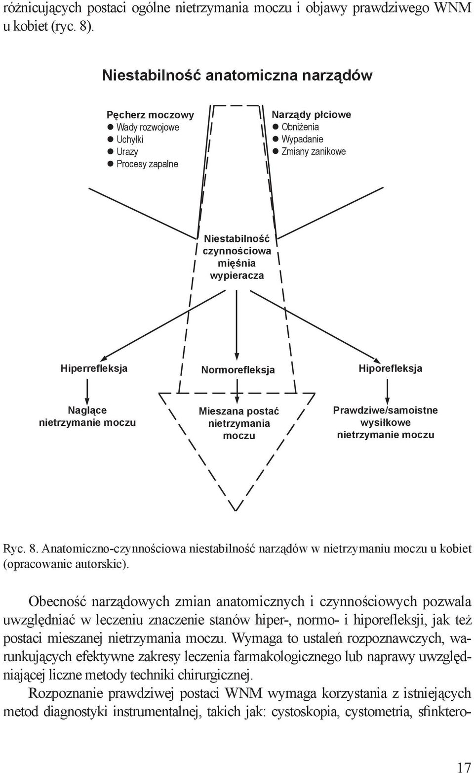 Hiperrefleksja Normorefleksja Hiporefleksja Naglące nietrzymanie moczu Mieszana postać nietrzymania moczu Prawdziwe/samoistne wysiłkowe nietrzymanie moczu Ryc. 8.