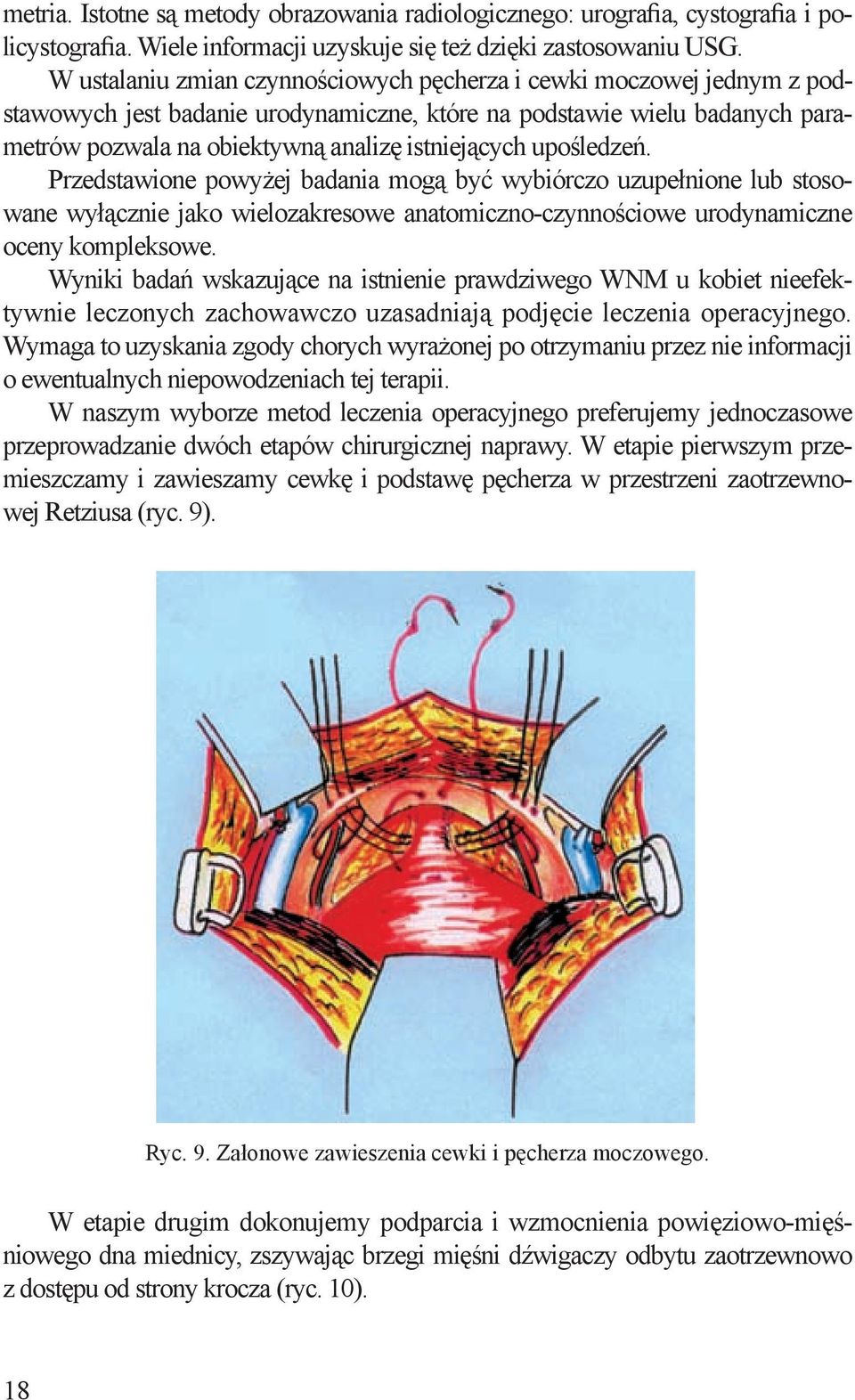 upośledzeń. Przedstawione powyżej badania mogą być wybiórczo uzupełnione lub stosowane wyłącznie jako wielozakresowe anatomiczno-czynnościowe urodynamiczne oceny kompleksowe.