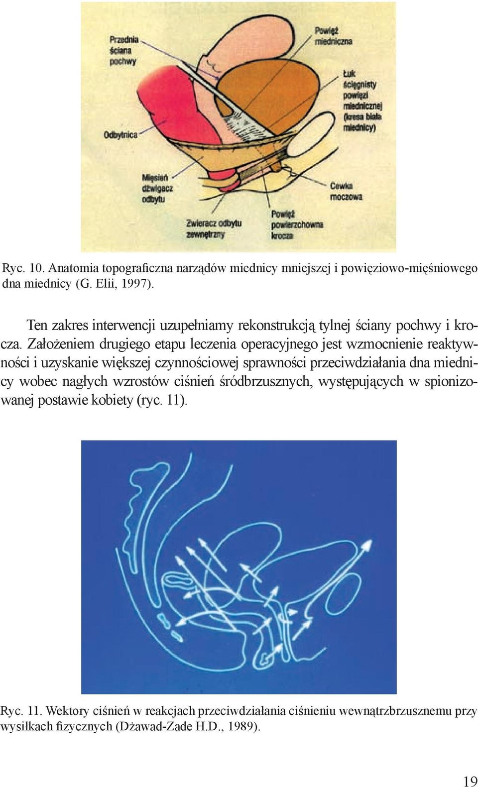 Założeniem drugiego etapu leczenia operacyjnego jest wzmocnienie reaktywności i uzyskanie większej czynnościowej sprawności przeciwdziałania dna