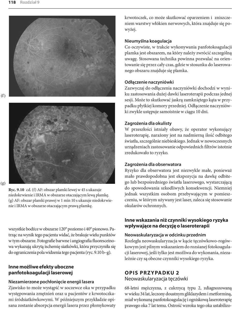 Stosowana technika powinna pozwalać na orientowanie się przez cały czas, gdzie w stosunku do laserowanego obszaru znajduje się plamka.