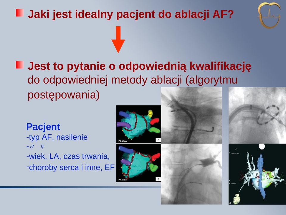 odpowiedniej metody ablacji (algorytmu postępowania)