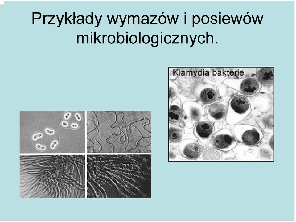 posiewów