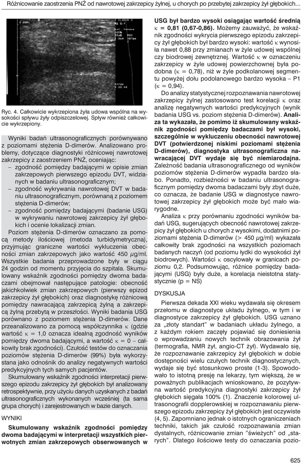 Analizowano problemy, dotyczące diagnostyki różnicowej nawrotowej zakrzepicy z zaostrzeniem PNŻ, oceniając: zgodność pomiędzy badającymi w opisie zmian zakrzepowych pierwszego epizodu DVT, widzianych