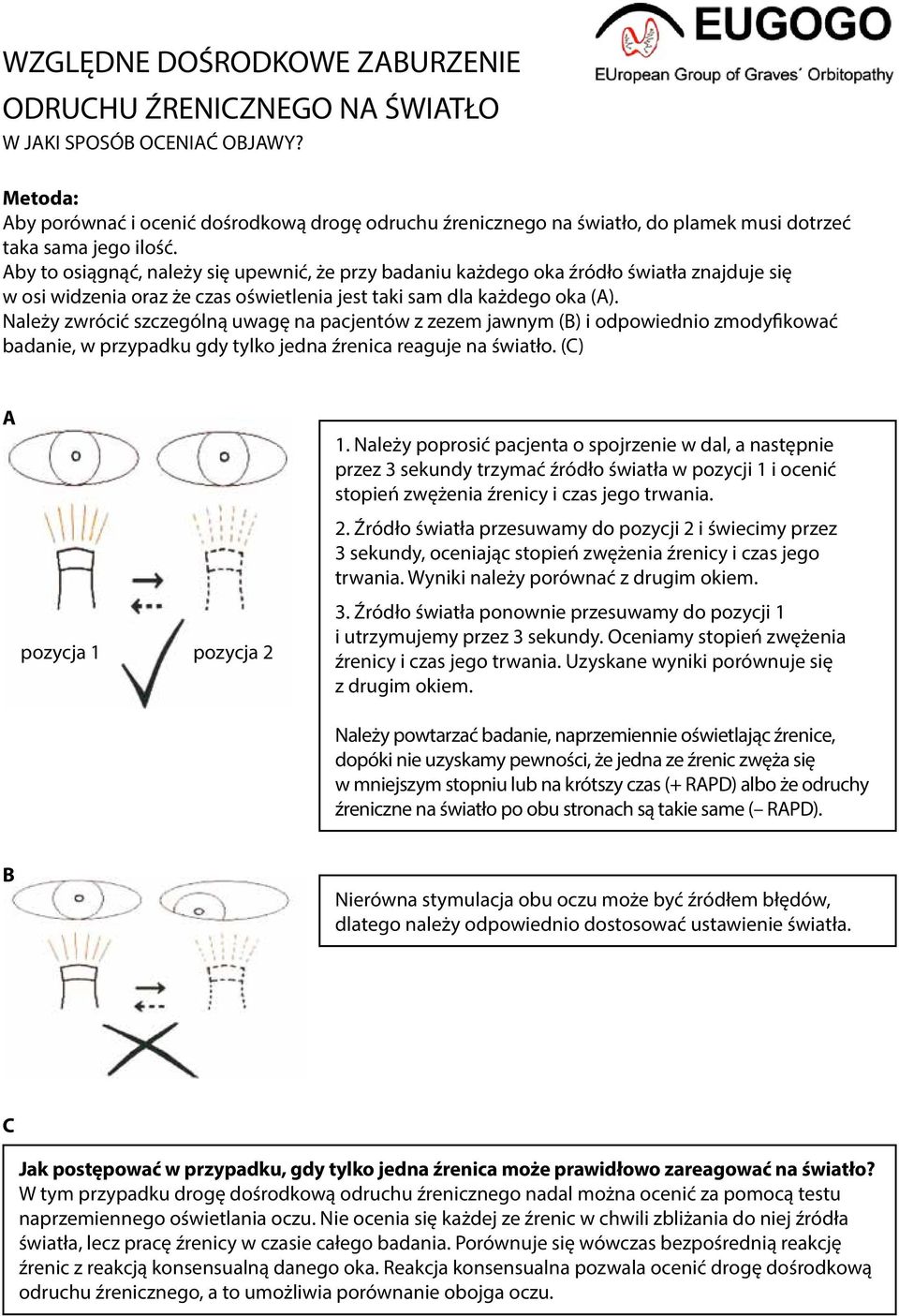 Należy zwrócić szczególną uwagę na pacjentów z zezem jawnym (B) i odpowiednio zmodyfikować badanie, w przypadku gdy tylko jedna źrenica reaguje na światło. (C) A pozycja 1 pozycja 2 1.