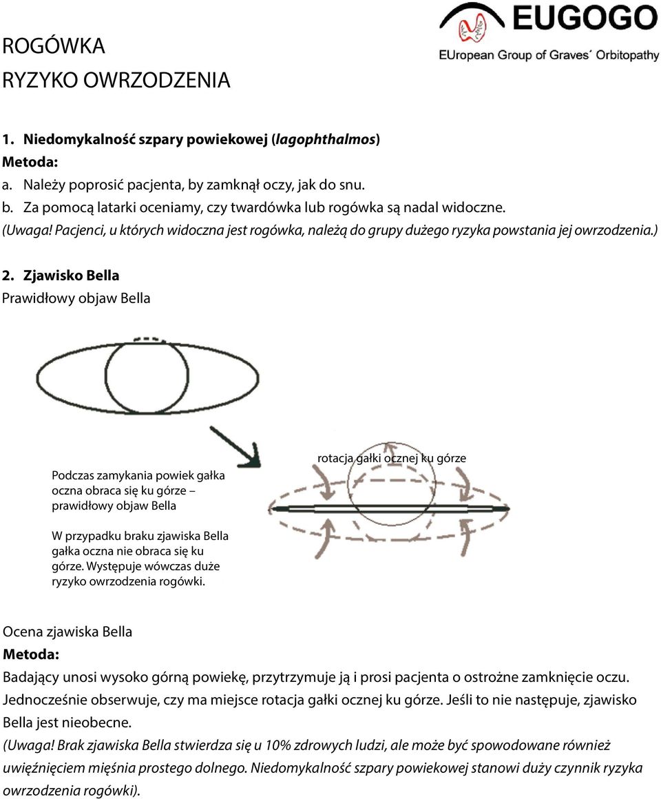 Zjawisko Bella Prawidłowy objaw Bella Podczas zamykania powiek gałka oczna obraca się ku górze prawidłowy objaw Bella rotacja gałki ocznej ku górze W przypadku braku zjawiska Bella gałka oczna nie