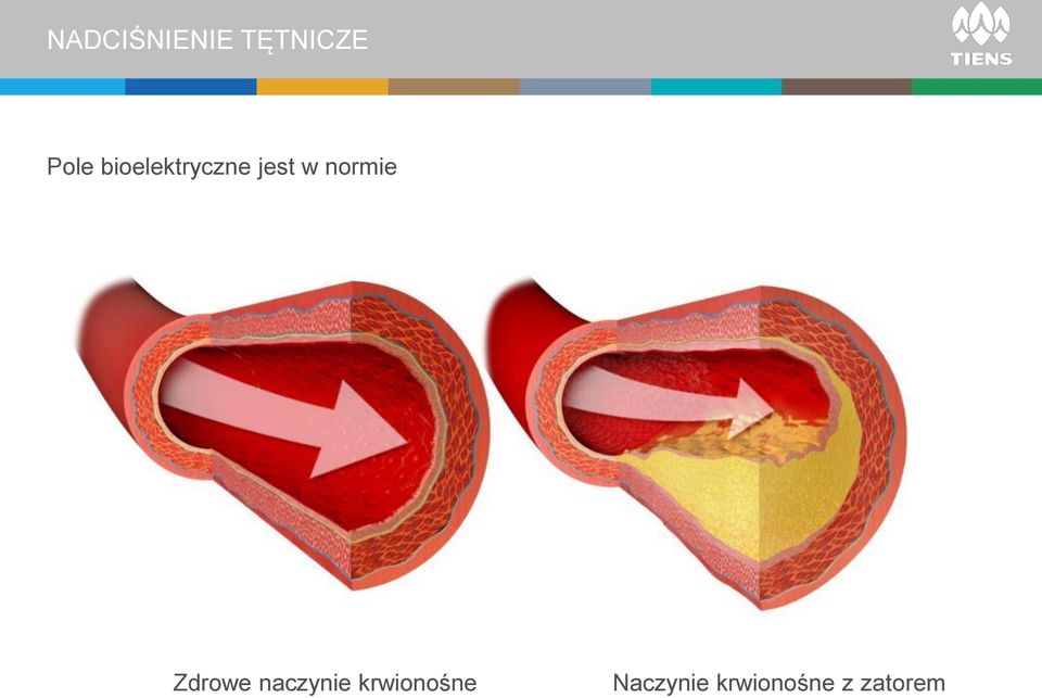 normie Zdrowe naczynie