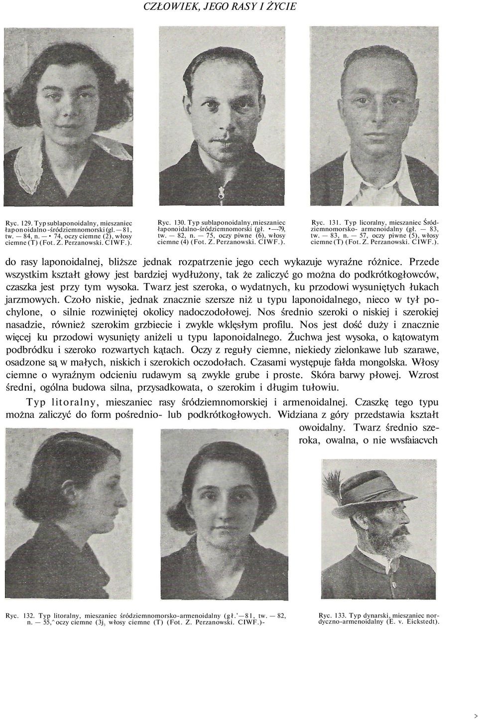 Typ licoralny, mieszaniec Śródziemnomorsko- armenoidalny (gł. 83, tw. 83, n. 57, oczy piwne (5), włosy ciemne (T) (Fot. Z. Perzanowski. CIWF.). do rasy laponoidalnej, bliższe jednak rozpatrzenie jego cech wykazuje wyraźne różnice.