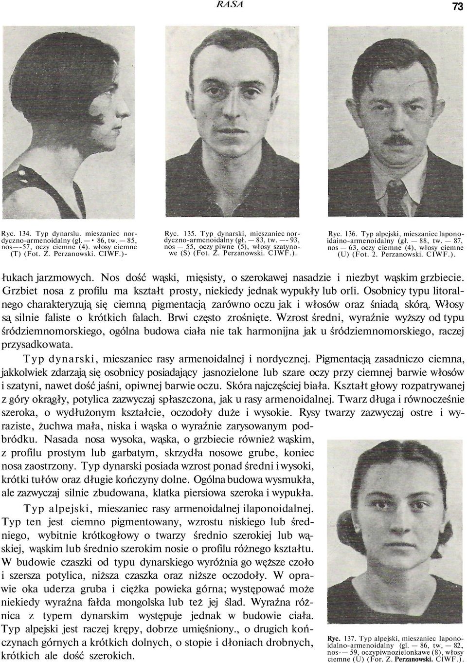 Typ alpejski, mieszaniec laponoidaino-armenoidalny (gł. 88, tw. 87, nos 63, oczy ciemne (4), włosy ciemne (U) (Fot. 2. Perzanowski. CIWF.). łukach jarzmowych.
