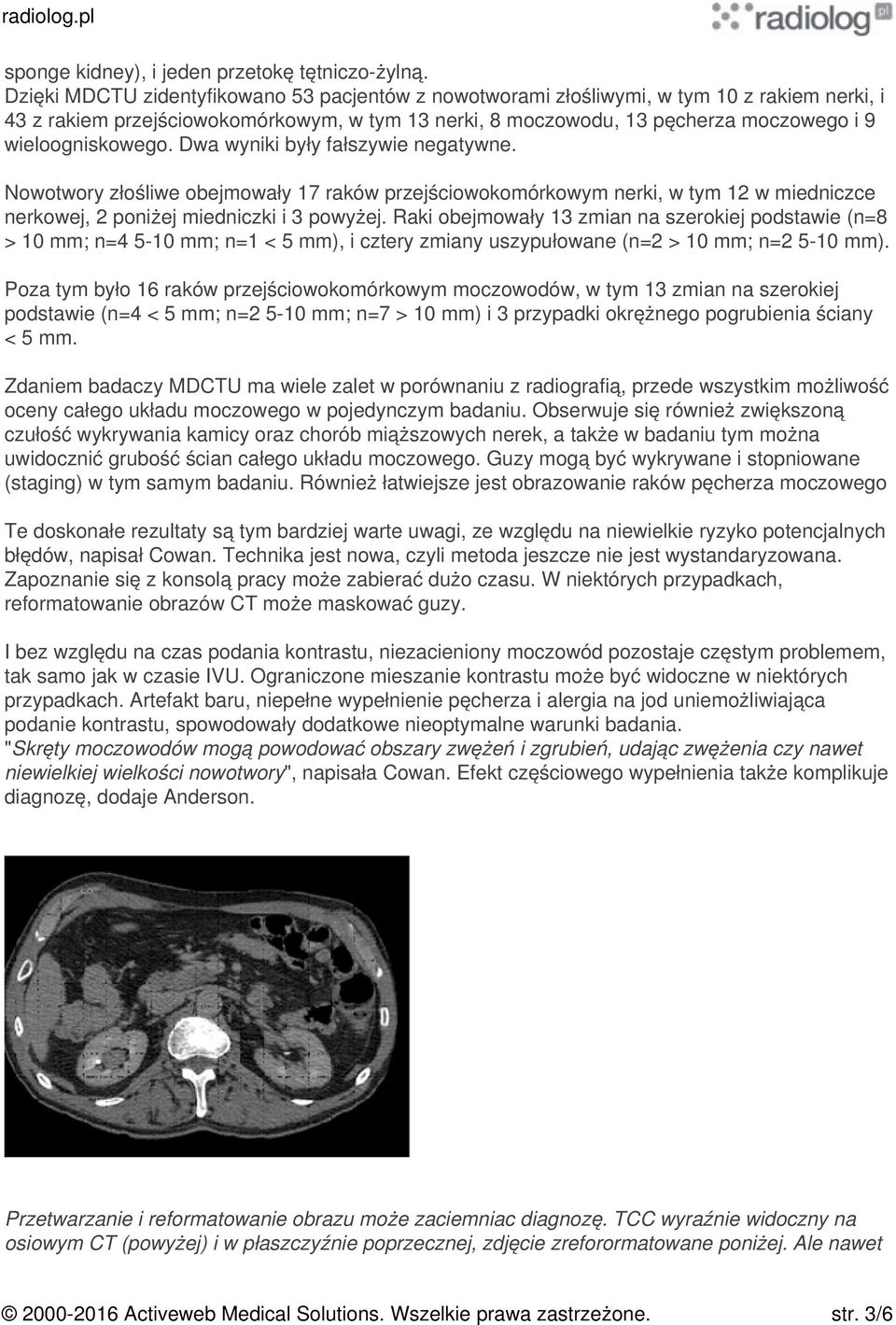 wieloogniskowego. Dwa wyniki były fałszywie negatywne. Nowotwory złośliwe obejmowały 17 raków przejściowokomórkowym nerki, w tym 12 w miedniczce nerkowej, 2 poniżej miedniczki i 3 powyżej.