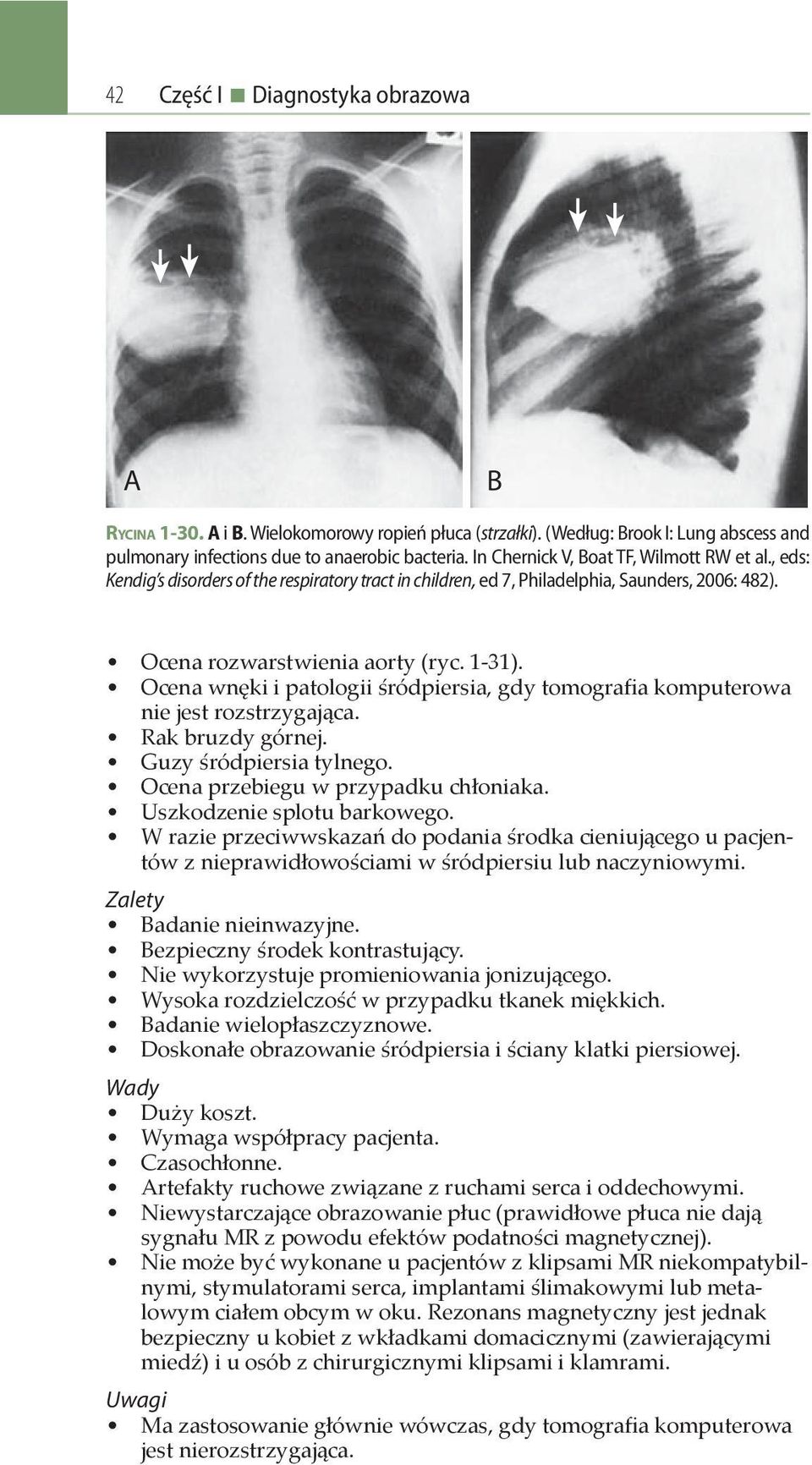 Ocena wnęki i patologii śródpiersia, gdy tomografia komputerowa nie jest rozstrzygająca. Rak bruzdy górnej. Guzy śródpiersia tylnego. Ocena przebiegu w przypadku chłoniaka.