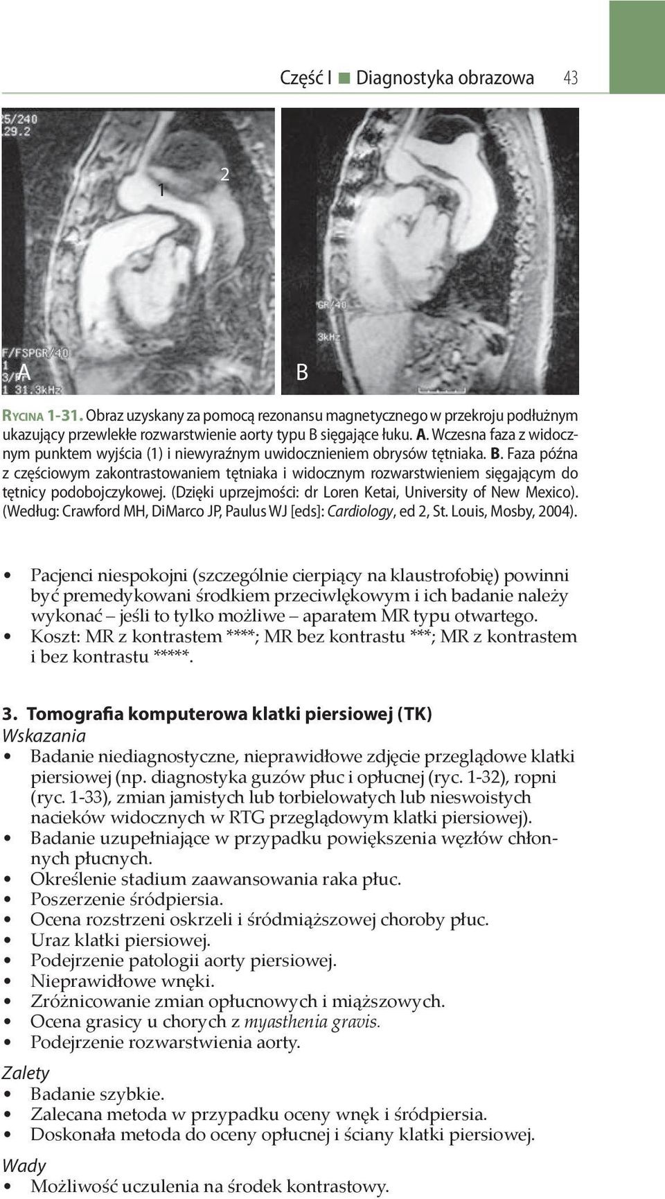 . Faza późna z częściowym zakontrastowaniem tętniaka i widocznym rozwarstwieniem sięgającym do tętnicy podobojczykowej. (Dzięki uprzejmości: dr Loren Ketai, University of New Mexico).