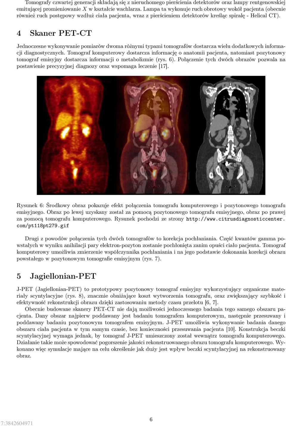 4 Skaner PET-CT Jednoczesne wykonywanie pomiarów dwoma różnymi typami tomografów dostarcza wielu dodatkowych informacji diagnostycznych.
