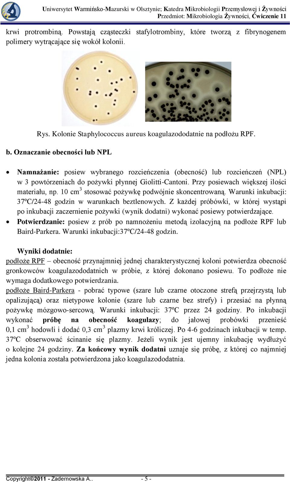 Przy posiewach większej ilości materiału, np. 10 cm 3 stosować pożywkę podwójnie skoncentrowaną. Warunki inkubacji: 37ºC/24-48 godzin w warunkach beztlenowych.