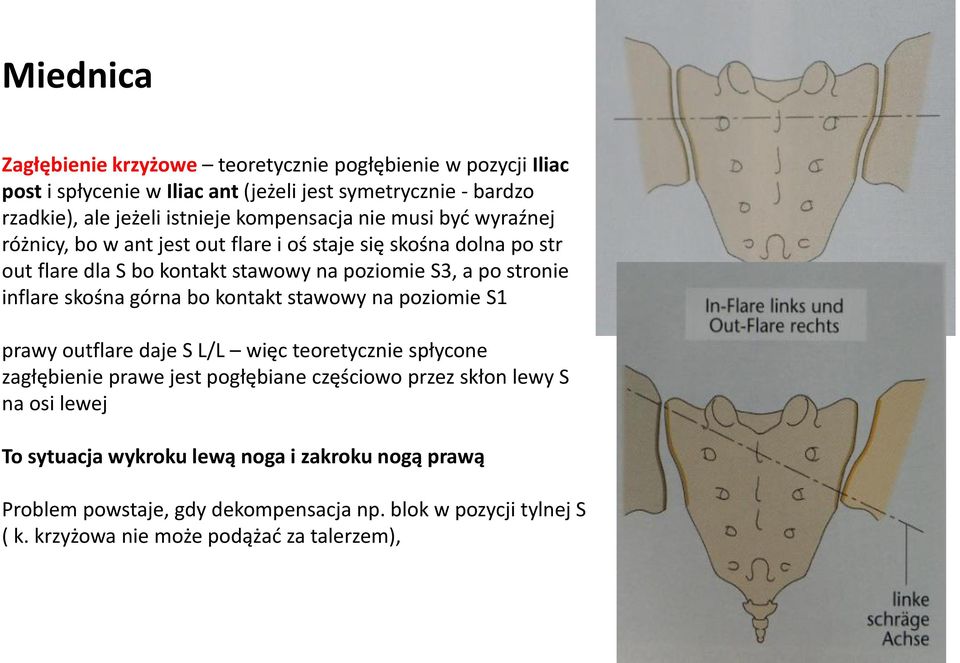 inflare skośna górna bo kontakt stawowy na poziomie S1 prawy outflare daje S L/L więc teoretycznie spłycone zagłębienie prawe jest pogłębiane częściowo przez skłon lewy