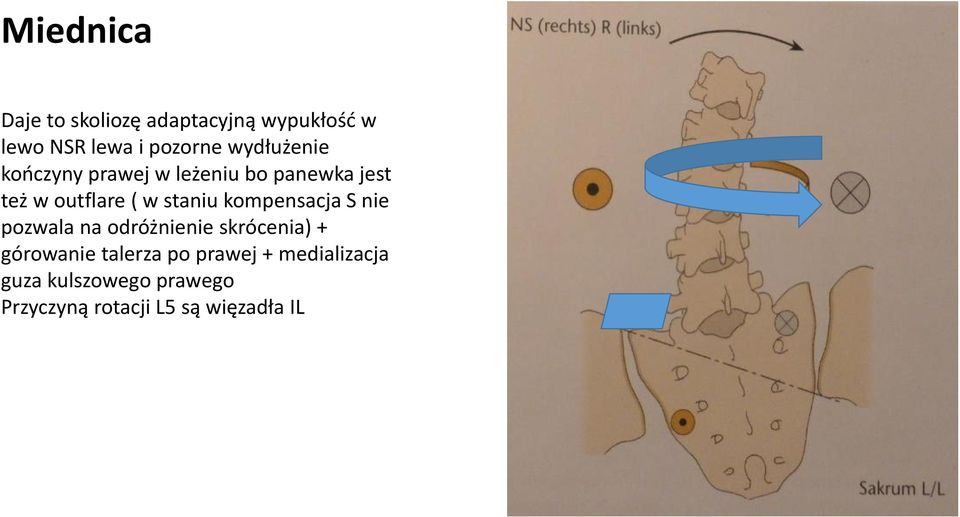 staniu kompensacja S nie pozwala na odróżnienie skrócenia) + górowanie