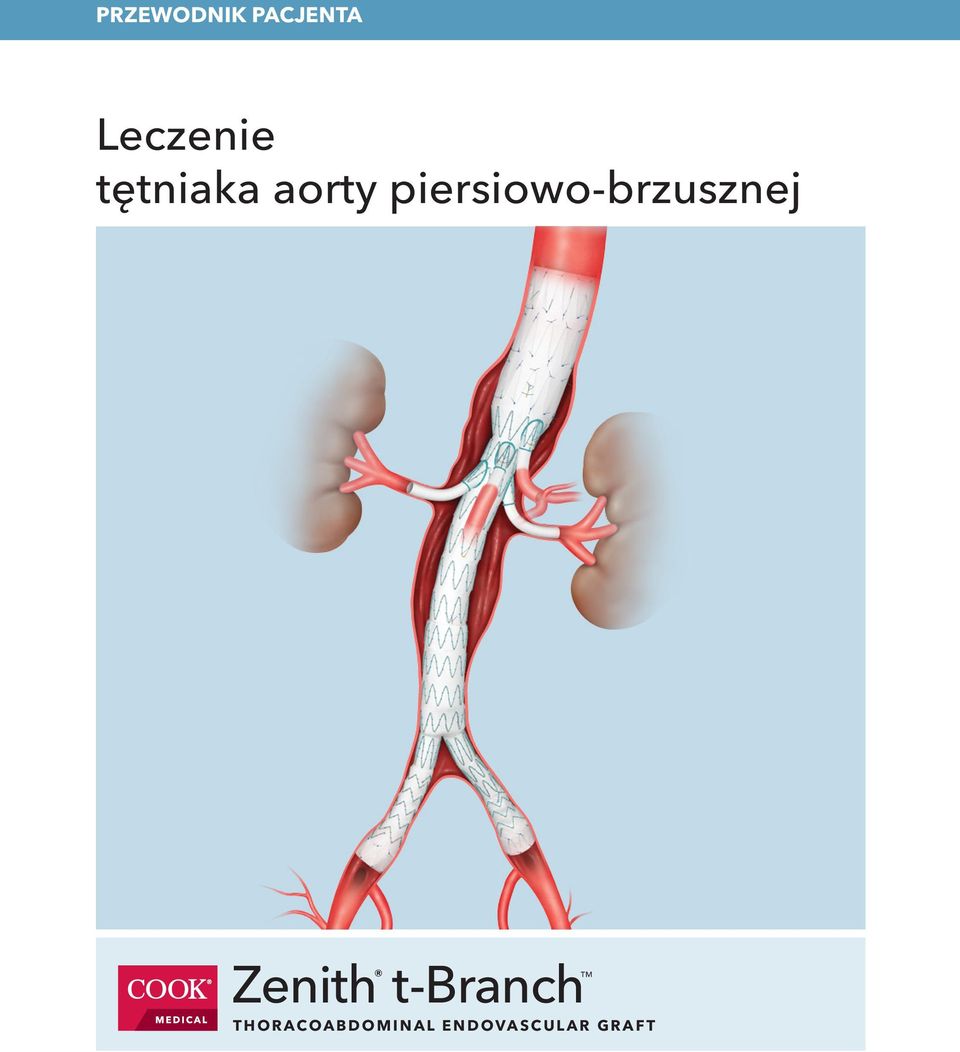 piersiowo-brzusznej Zenith