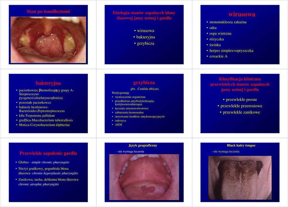 kiła-treponema pallidum gruźlica-mucobacterium tubercullosis błonica-corynobacterium diphteriae grzybicza głw.