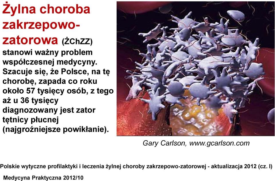 diagnozowany jest zator tętnicy płucnej (najgroźniejsze powikłanie). Gary Carlson, www.gcarlson.