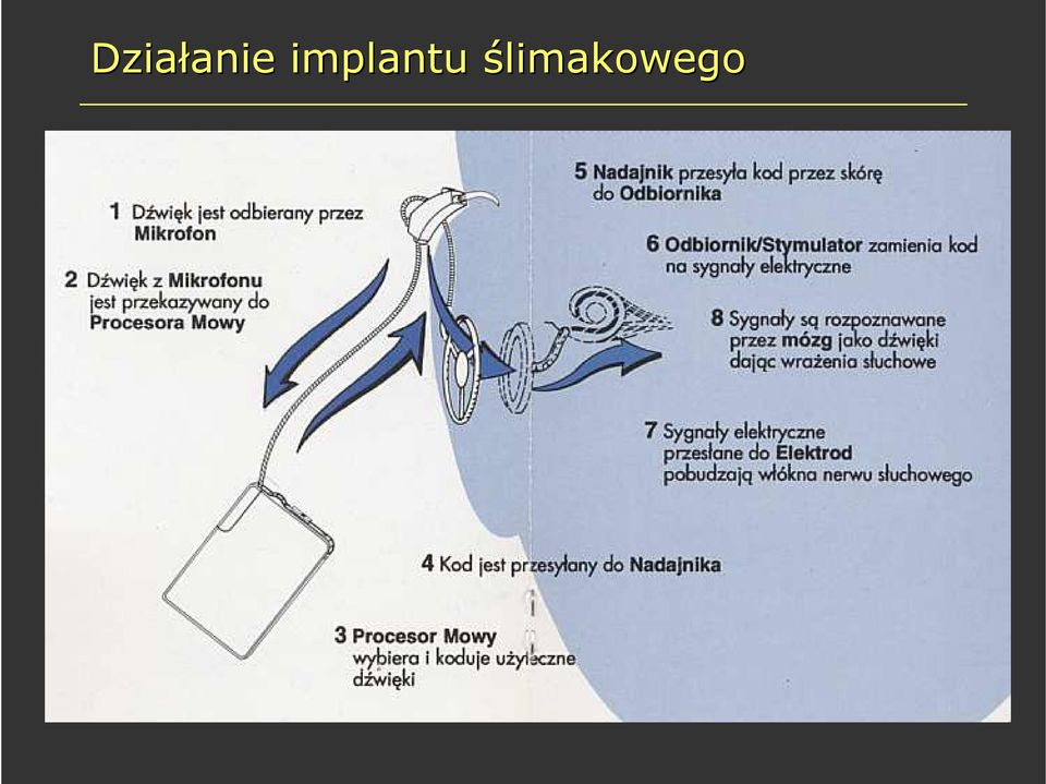 implantu