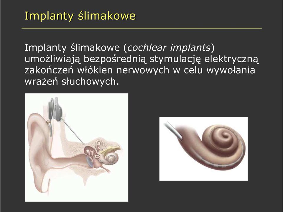 bezpośrednią stymulację elektryczną