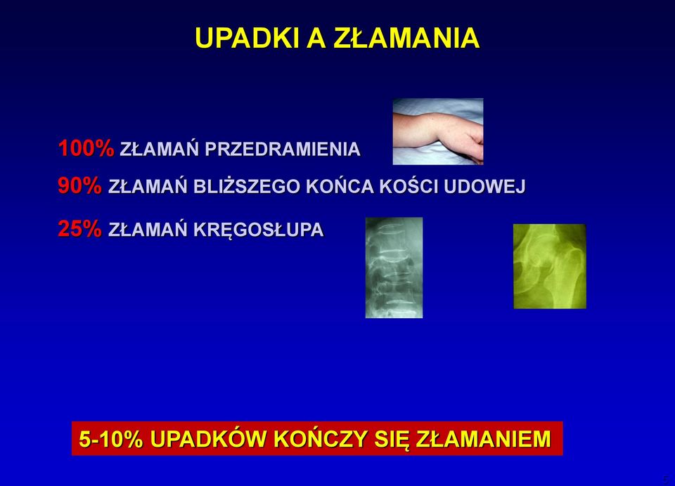 KOŃCA KOŚCI UDOWEJ 25% ZŁAMAŃ