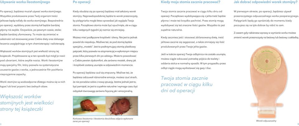 organizm treści stomijny. Najprawdopodobniej będzie to worek przezroczysty, operacji. Początkowo wydobywająca się z jelita treść będzie przezroczystego odpuszczalnego worka pooperacyjnego.