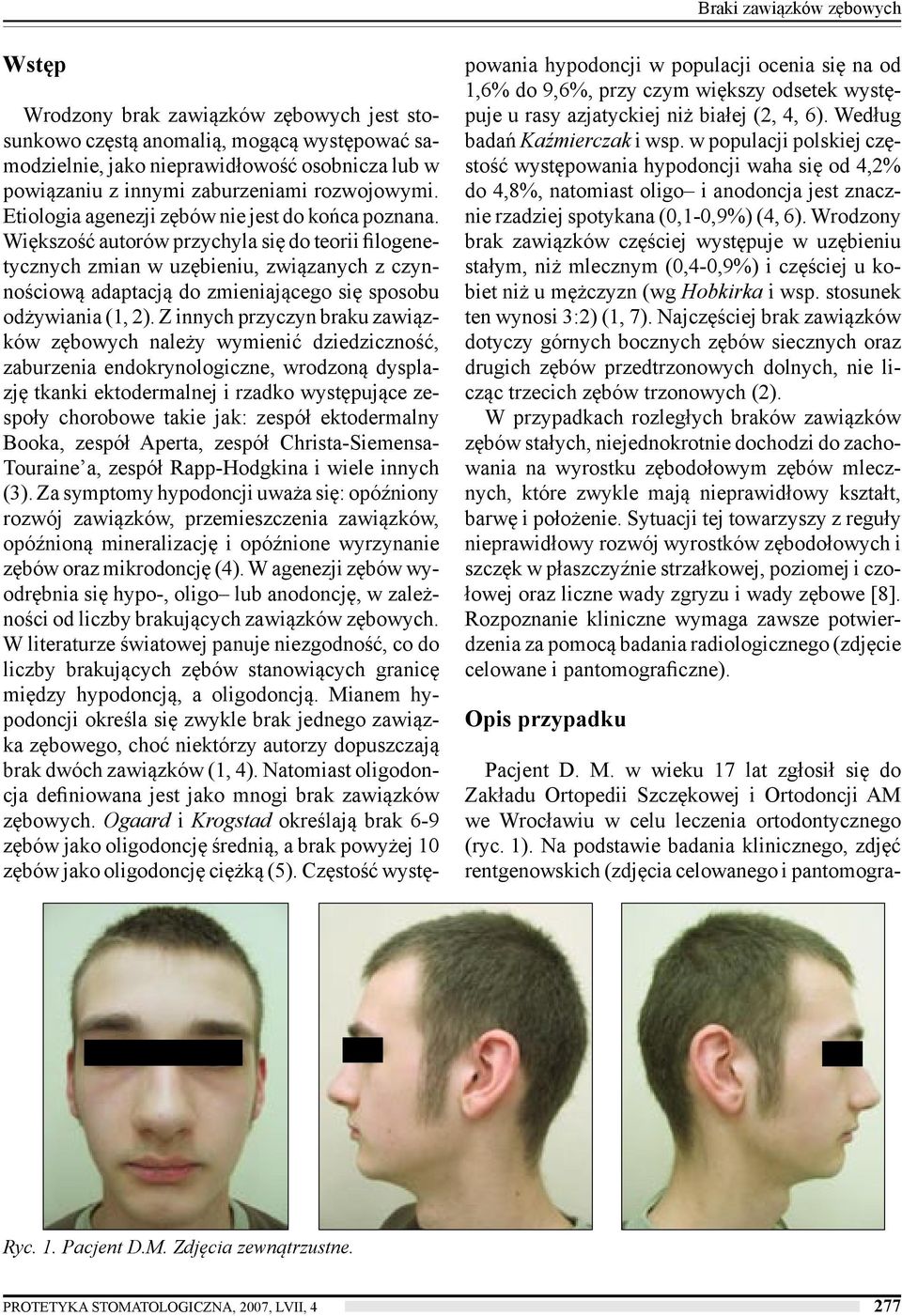 Większość autorów przychyla się do teorii filogenetycznych zmian w uzębieniu, związanych z czynnościową adaptacją do zmieniającego się sposobu odżywiania (1, 2).