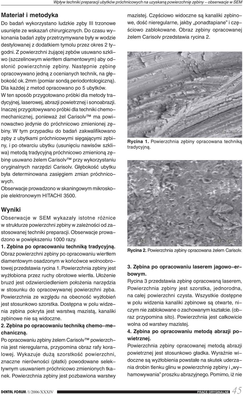 Z powierzchni żującej zębów usuwano szkli wo (szczelinowym wiertłem diamentowym) aby od słonić powierzchnię zębiny. Następnie zębinę opracowywano jedną z ocenianych technik, na głę bokość ok.