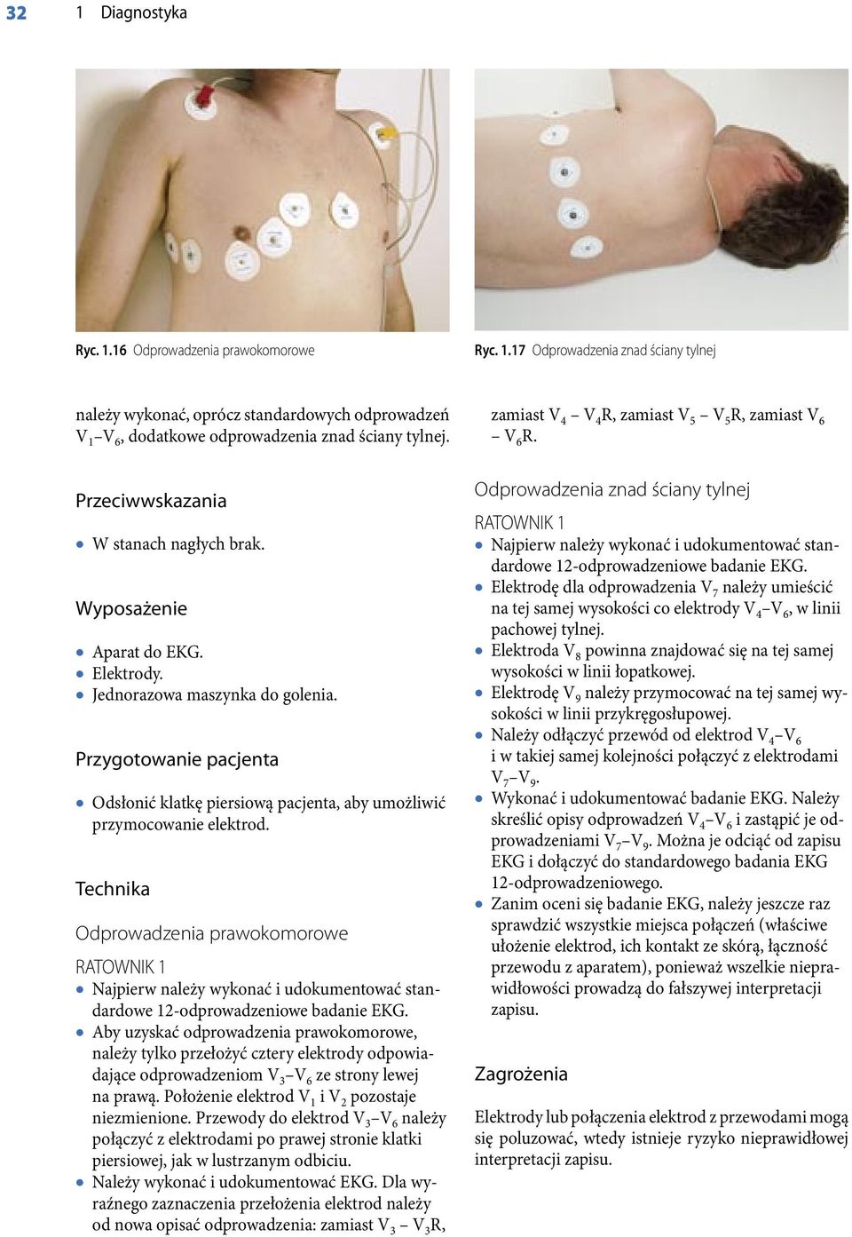 Odprowadzenia prawokomorowe RATOWNIK 1 Najpierw należy wykonać i udokumentować standardowe 12-odprowadzeniowe badanie EKG.