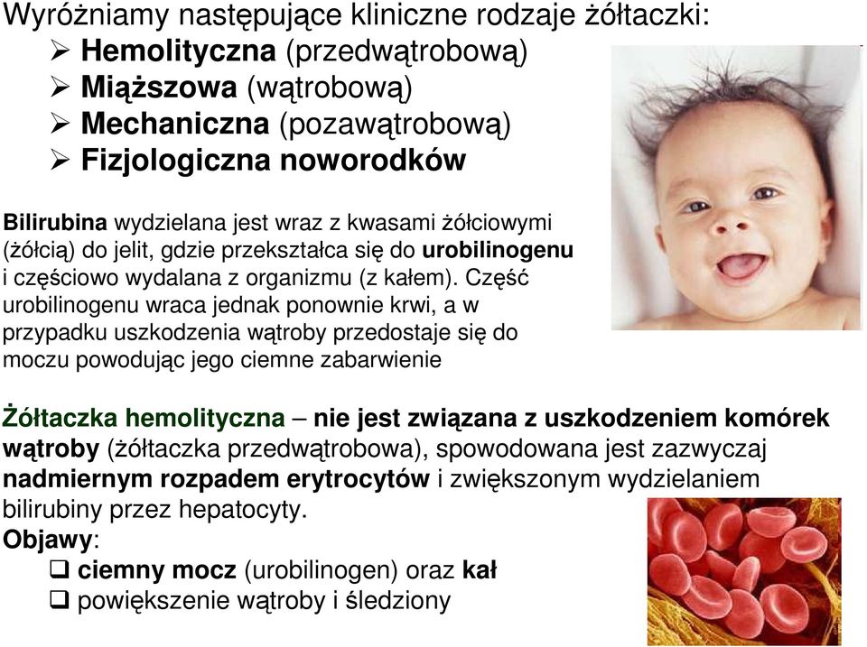 Część urobilinogenu wraca jednak ponownie krwi, a w przypadku uszkodzenia wątroby przedostaje się do moczu powodując jego ciemne zabarwienie śółtaczka hemolityczna nie jest związana z