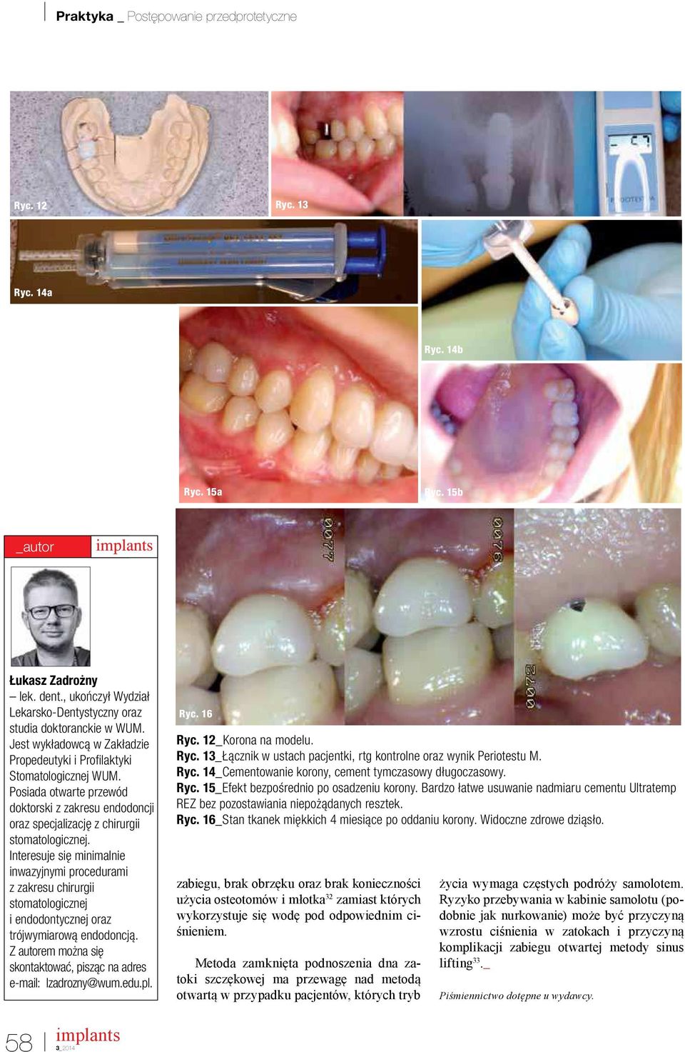 Interesuje się minimalnie inwazyjnymi procedurami z zakresu chirurgii stomatologicznej i endodontycznej oraz trójwymiarową endodoncją.