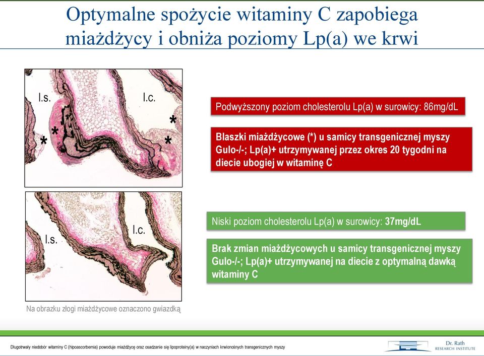 i obniża poziomy Lp(a) we krwi l.s. l.c.