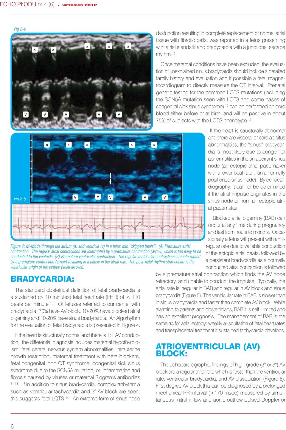 V V V V V Once maternal conditions have been excluded, the evaluation of unexplained sinus bradycardia should include a detailed family history and evaluation and if possible a fetal