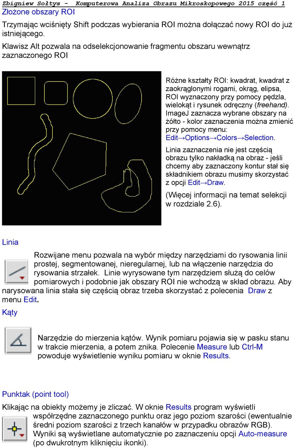 wielokąt i rysunek odręczny (freehand). ImageJ zaznacza wybrane obszary na żółto - kolor zaznaczenia można zmienić przy pomocy menu: Edit Options Colors Selection.